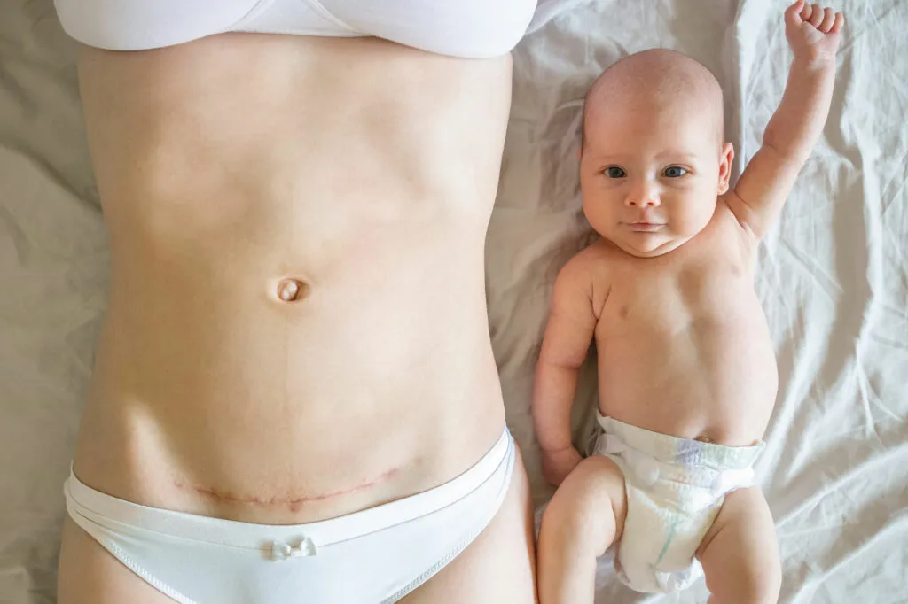 Pregnancy chiropractor